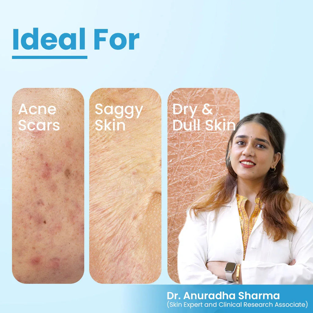 FCL Bio Retinol Body Lotion, For SkinAgeing, Keratosis Pilaris, Smoothen, Bumpy & Tanned Skin - Doorderma