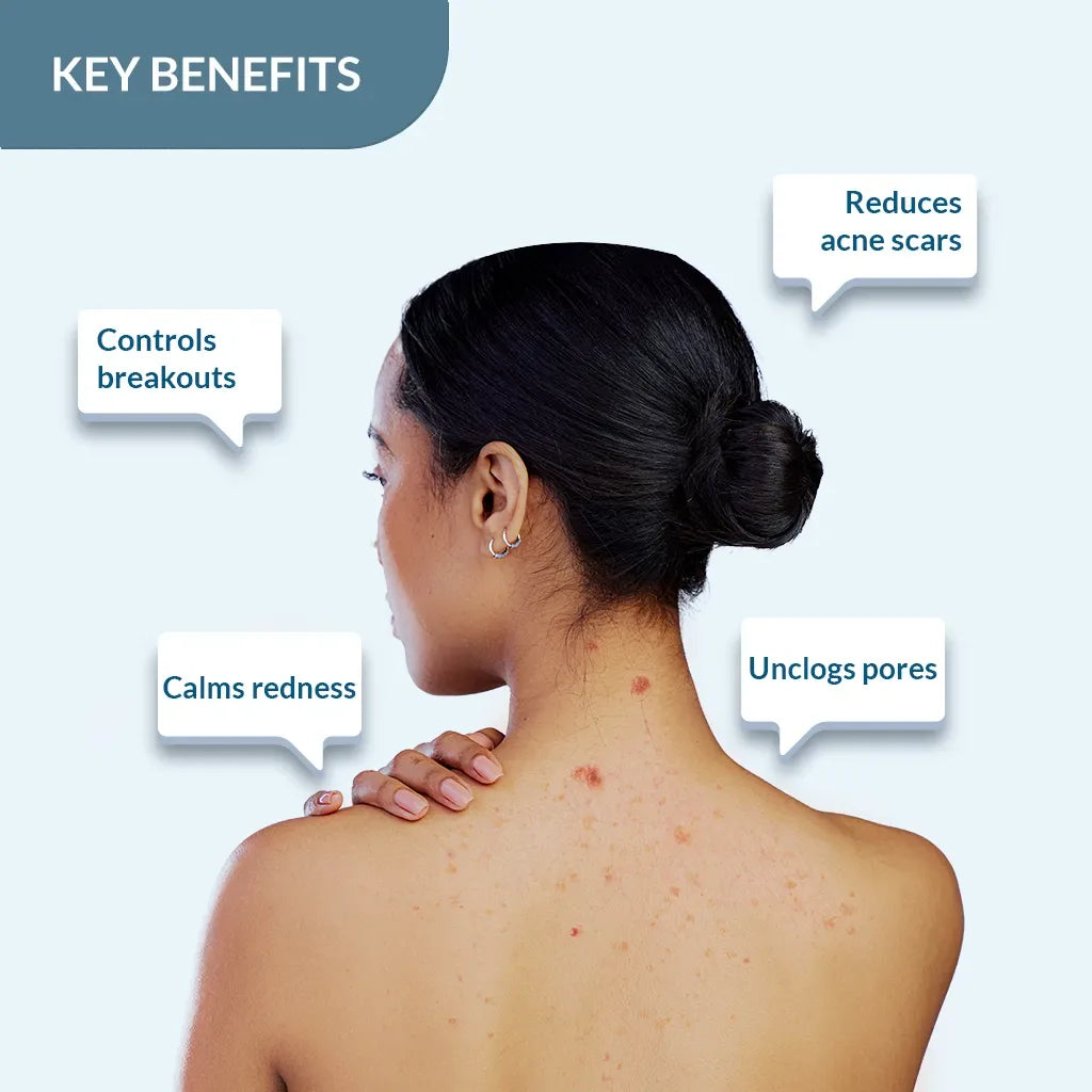 Salyzap Body Wash | Soap-Free Wash to Combat Stubborn Body Acne - Doorderma