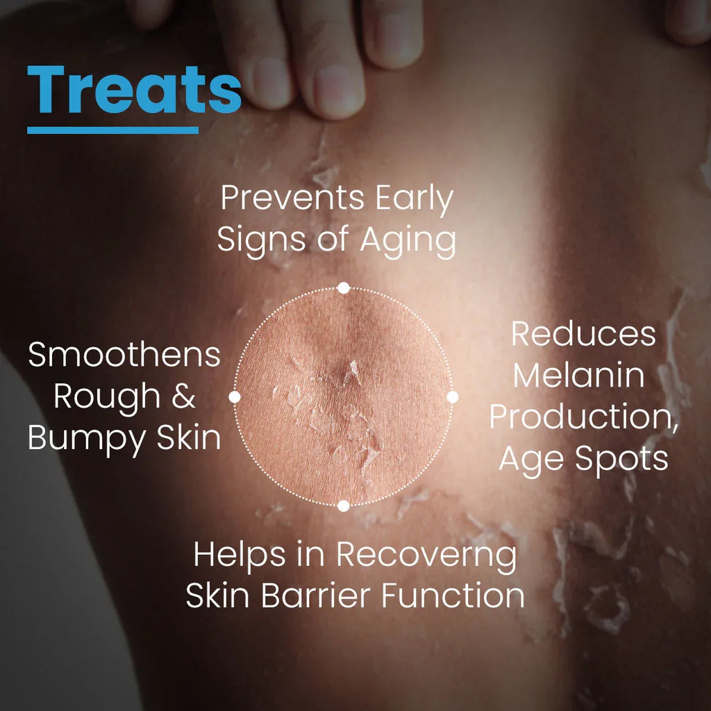 FCL Bio Retinol Body Lotion, For SkinAgeing, Keratosis Pilaris, Smoothen, Bumpy & Tanned Skin - Doorderma