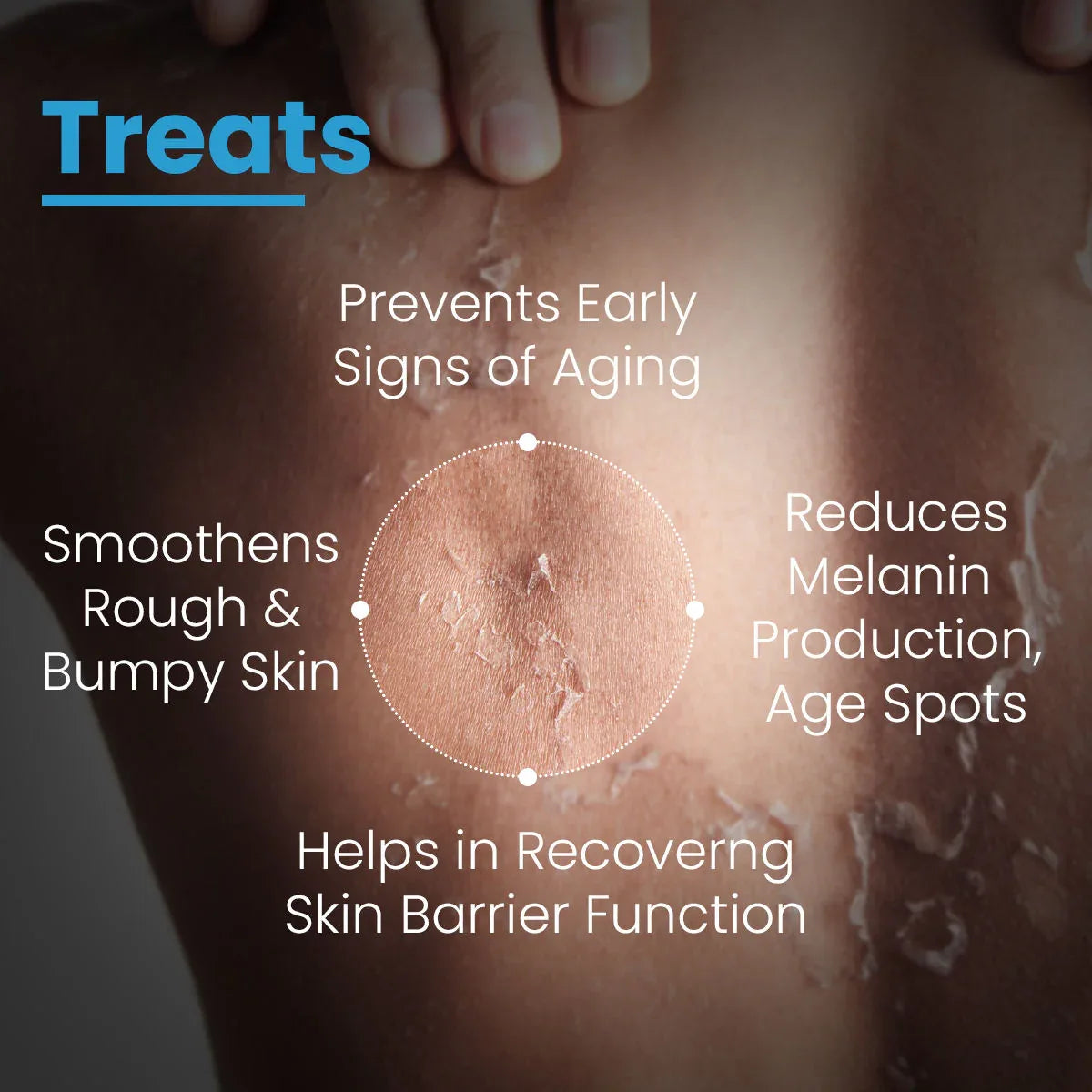 FCL Bio Retinol Body Lotion, For SkinAgeing, Keratosis Pilaris, Smoothen, Bumpy & Tanned Skin - Doorderma