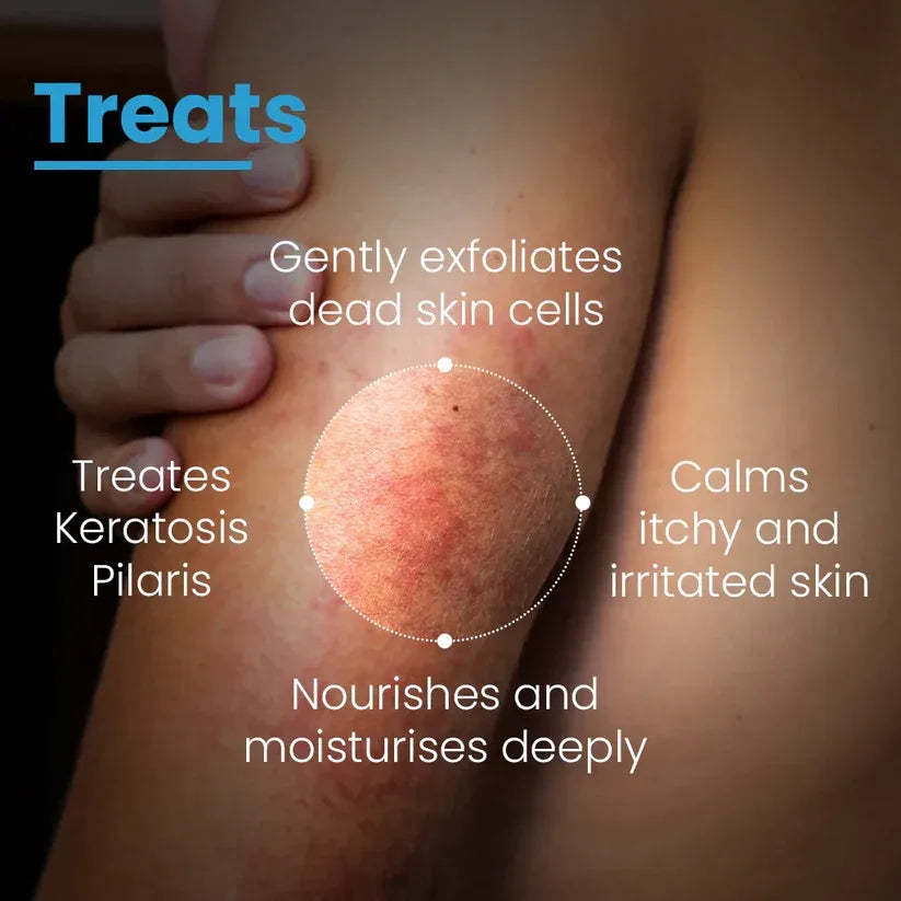 Fixderma AHA Resurfacing Lotion 20% - Doorderma