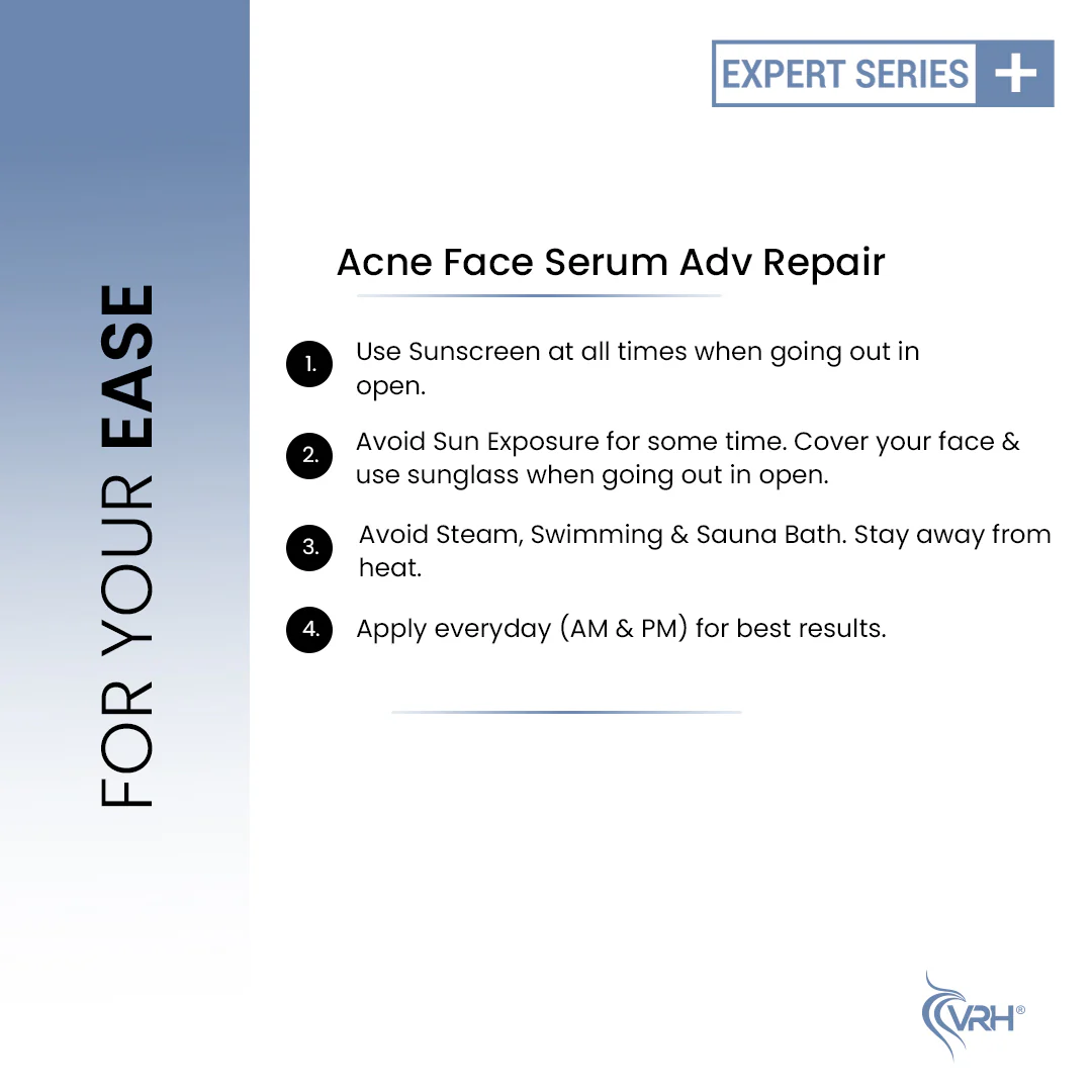 VRH ACNE FACE SERUM 30ML | Clears Acne, Reduces Blemishes & Soothes Skin | 30ml