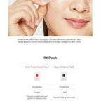 Cosrx Acne Pimple Master Patches - 24 Pieces | Discreet & Waterproof Acne Spot Treatment Patches for Sensitive Skin - Doorderma