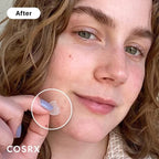 Cosrx Acne Pimple Master Patches - 24 Pieces | Discreet & Waterproof Acne Spot Treatment Patches for Sensitive Skin - Doorderma