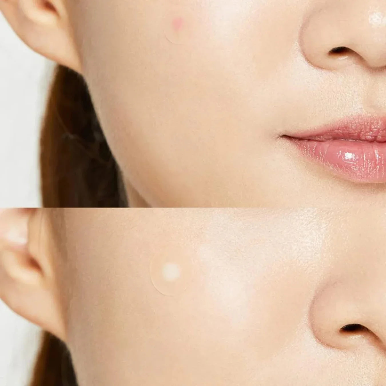 Cosrx Acne Pimple Master Patches - 24 Pieces | Discreet & Waterproof Acne Spot Treatment Patches for Sensitive Skin - Doorderma