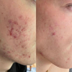 Doorderma Azelaic Face Serum with Probiotic, Ceramides & Cica – 40 ml