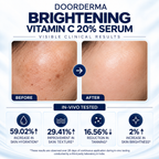 DOORDERMA Brightening Vitamin C 20% Face Serum | Dark Spots, Pigmentation & Uneven Skin Tone