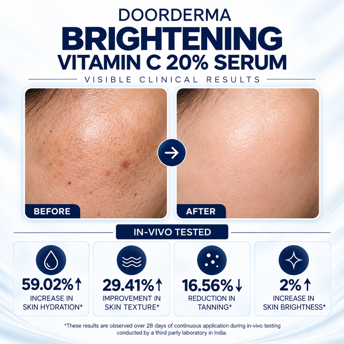 DOORDERMA Brightening Vitamin C 20% Face Serum | Dark Spots, Pigmentation & Uneven Skin Tone