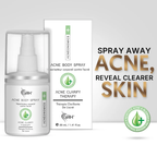 VRH ACNE BODY SPRAY 50ML | Triple Acid Blend with Salicylic, Azelaic & Mandelic Acids | 50ml