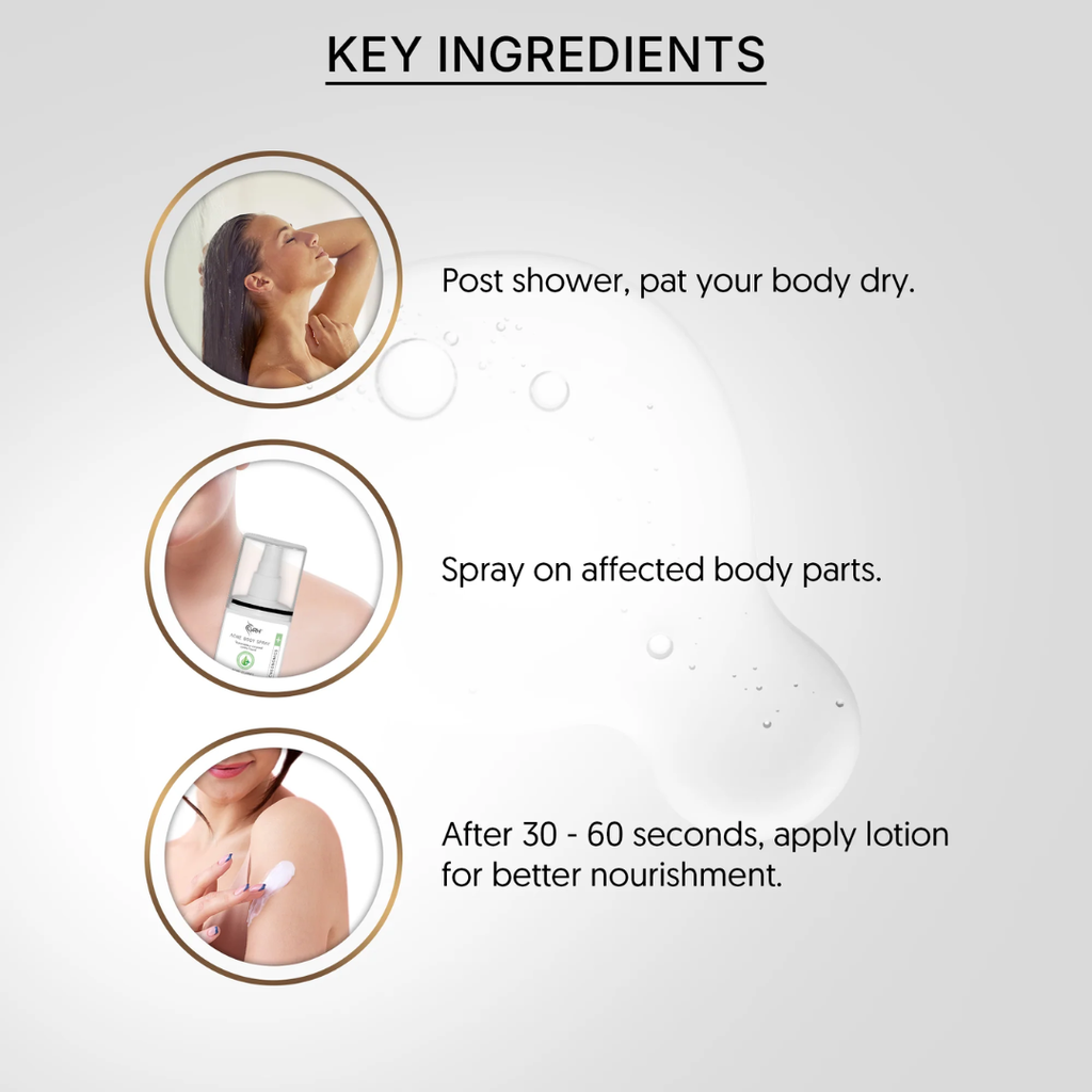 VRH ACNE BODY SPRAY 50ML | Triple Acid Blend with Salicylic, Azelaic & Mandelic Acids | 50ml