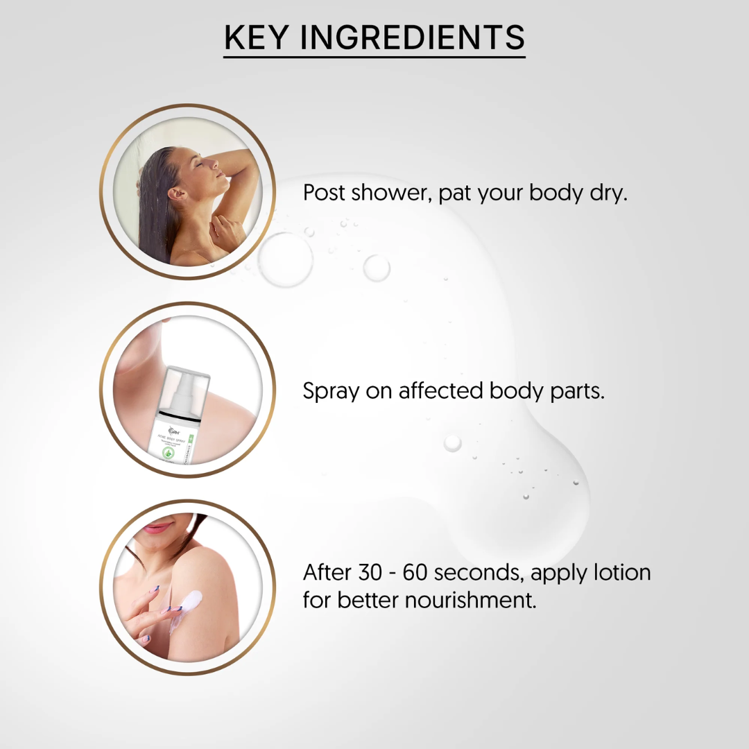 VRH ACNE BODY SPRAY 50ML | Triple Acid Blend with Salicylic, Azelaic & Mandelic Acids | 50ml